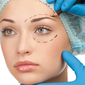 Blefaroplastia